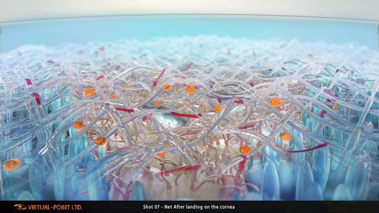 Sh_07_Net_After_landing