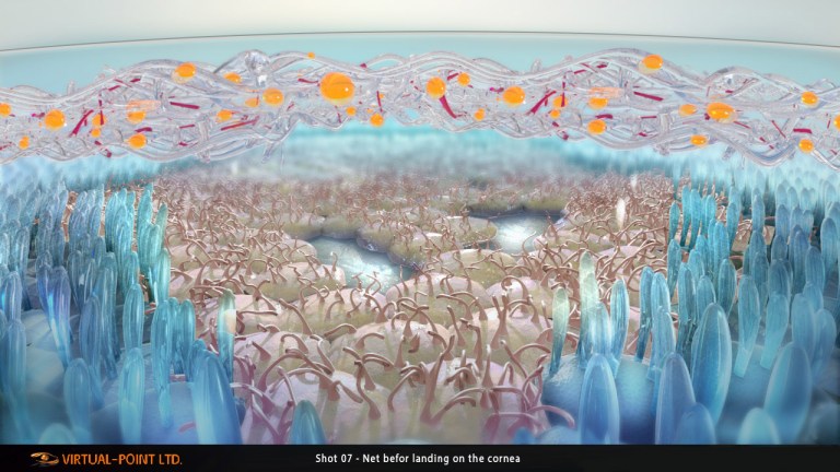 Sh_07_Net_Before_landing